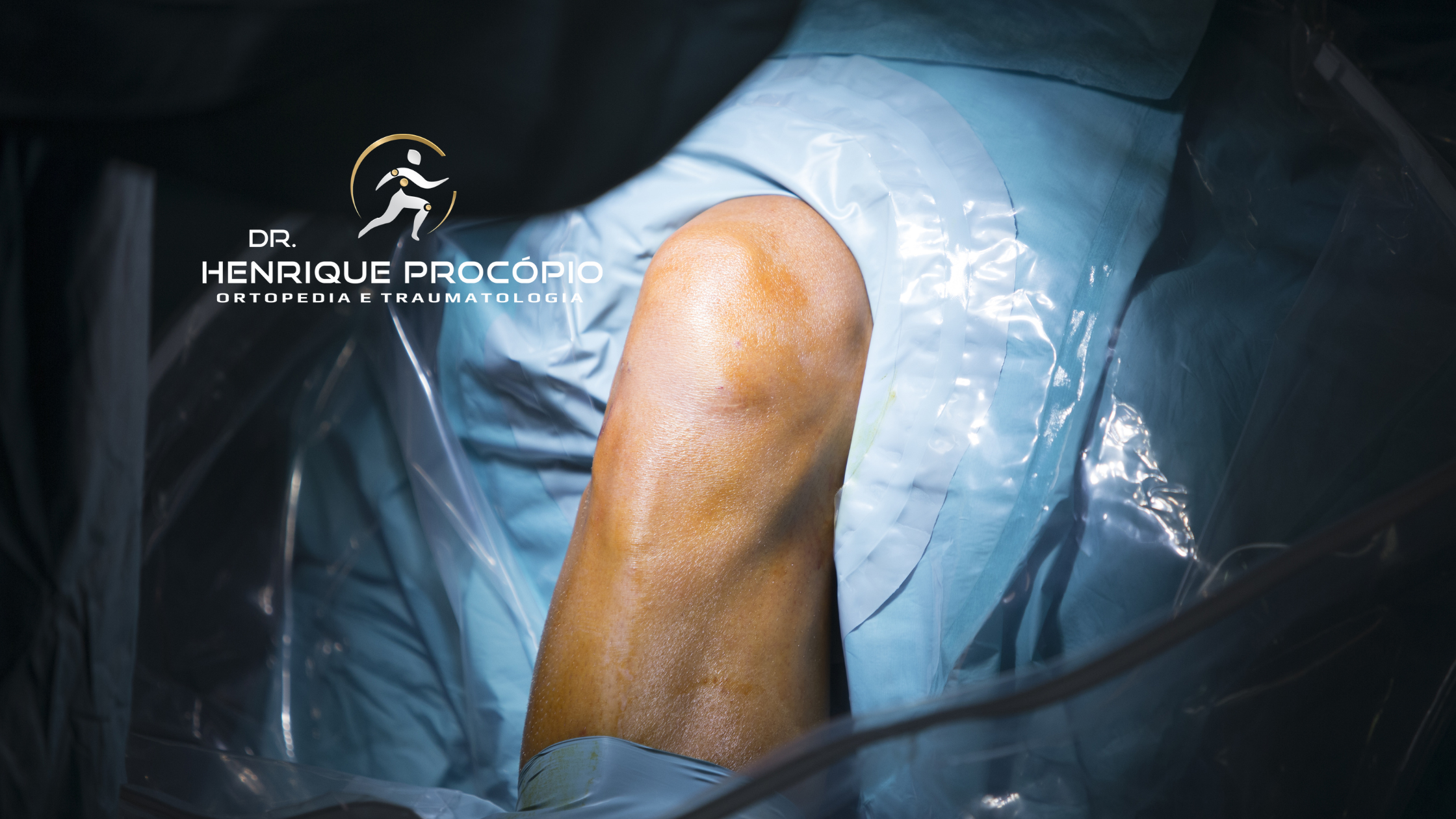 Médico ortopedista realizando cirurgia artroscópica com equipamentos modernos.