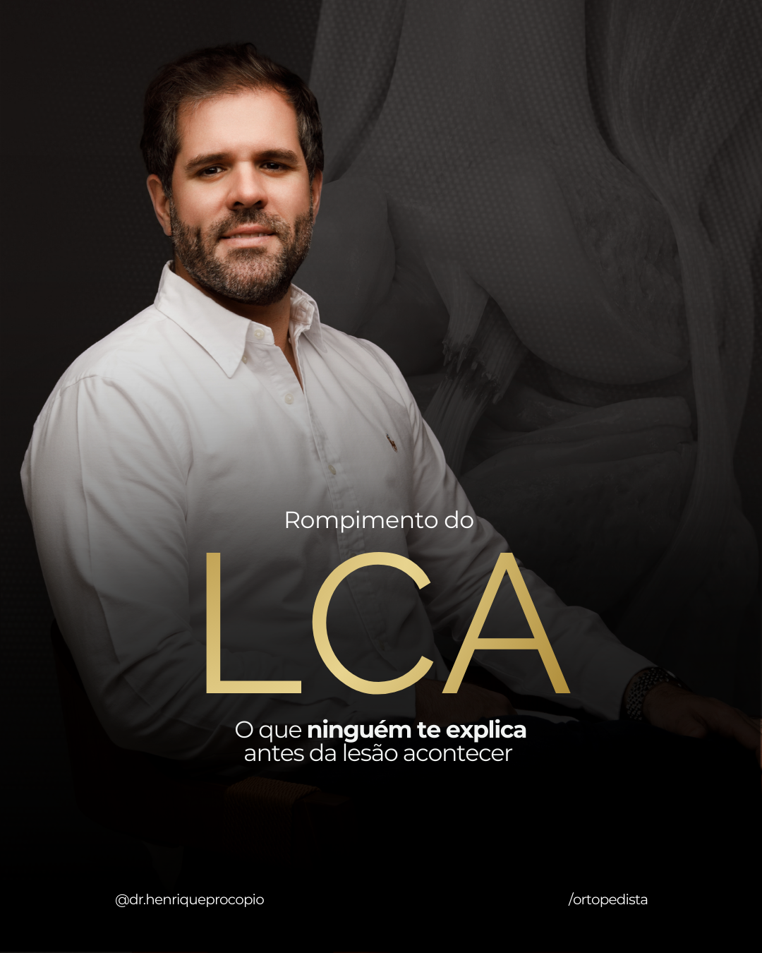 LCA: O que ninguém te explica antes da lesão acontecer