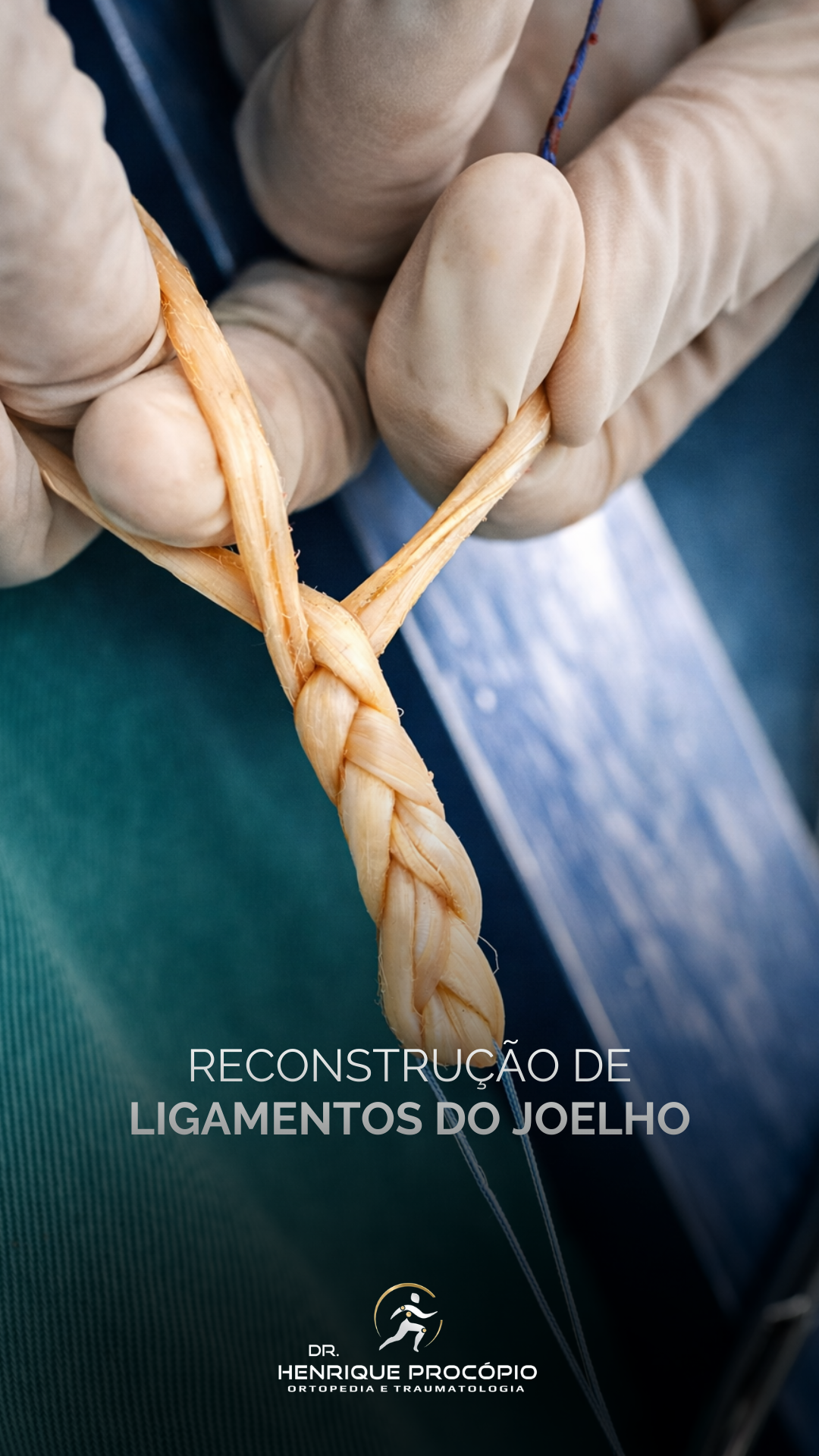 Reconstrução de ligamentos do joelho: entendendo o que acontece na prática